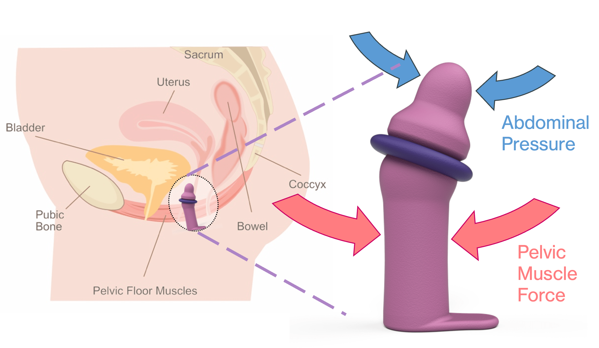 Freyya Device Diagram